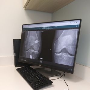 Meet your Posher, Neil